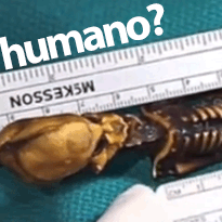 Esqueleto de “Alien” tem DNA humano