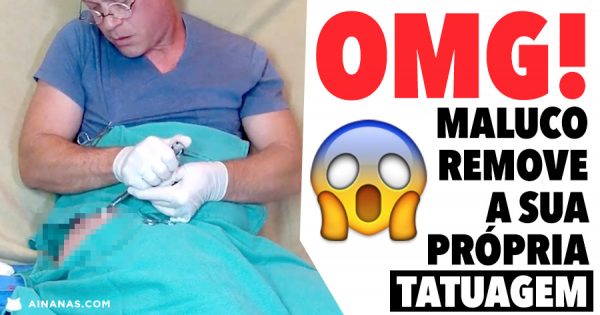 OMG! Maluco Remove Cirurgicamente a Sua Própria Tatuagem