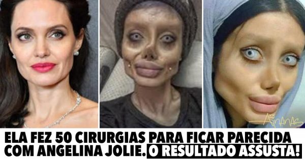Ela fez 50 CIRURGIAS para ficar parecida com Angelina Jolie.. mas o resultado é assustador!