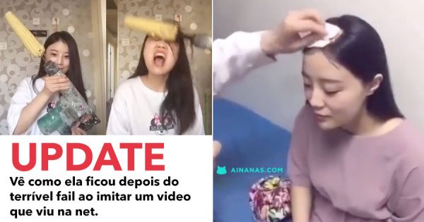 Vê como ficou a Rapariga que Tentou comer Maçaroca de Milho com Berbequim