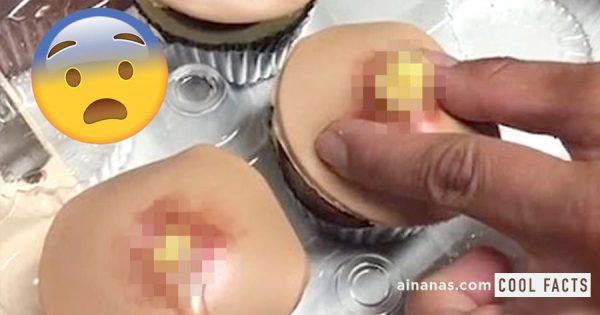 Cupcakes da Dra. Pimple Popper são O NOJO