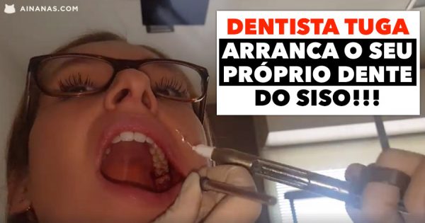 Dentista portuguesa ARRANCA O SEU PRÓPRIO dente do siso