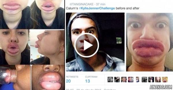 Kylie Jenner Lip Challenge: COMPILAÇÃO