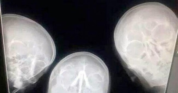 Selfie de Radiologistas Torna-se Sucesso Viral