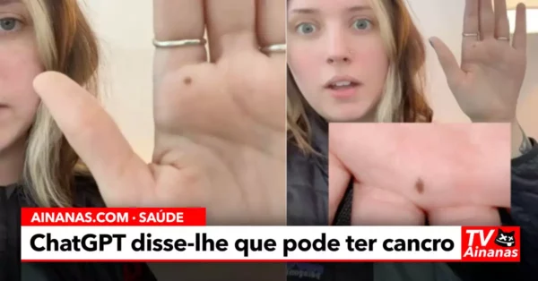 ChatGPT Deteta Possível Cancro ao ler Palma de Mão