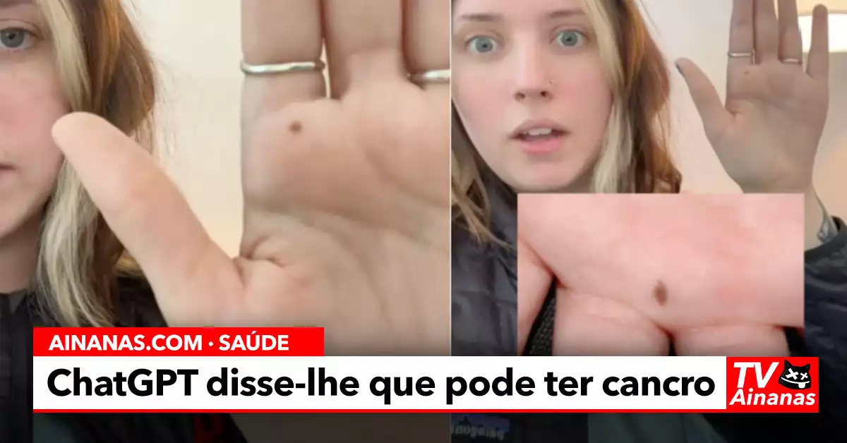 ChatGPT Deteta Possível Cancro ao ler Palma de Mão